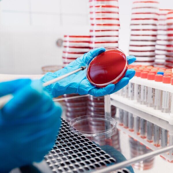 Cynaecology Culture Test