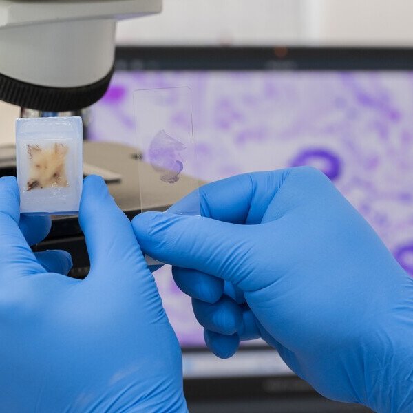 Biopsy test 